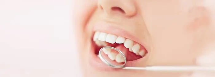 موارد مضر برای دندان